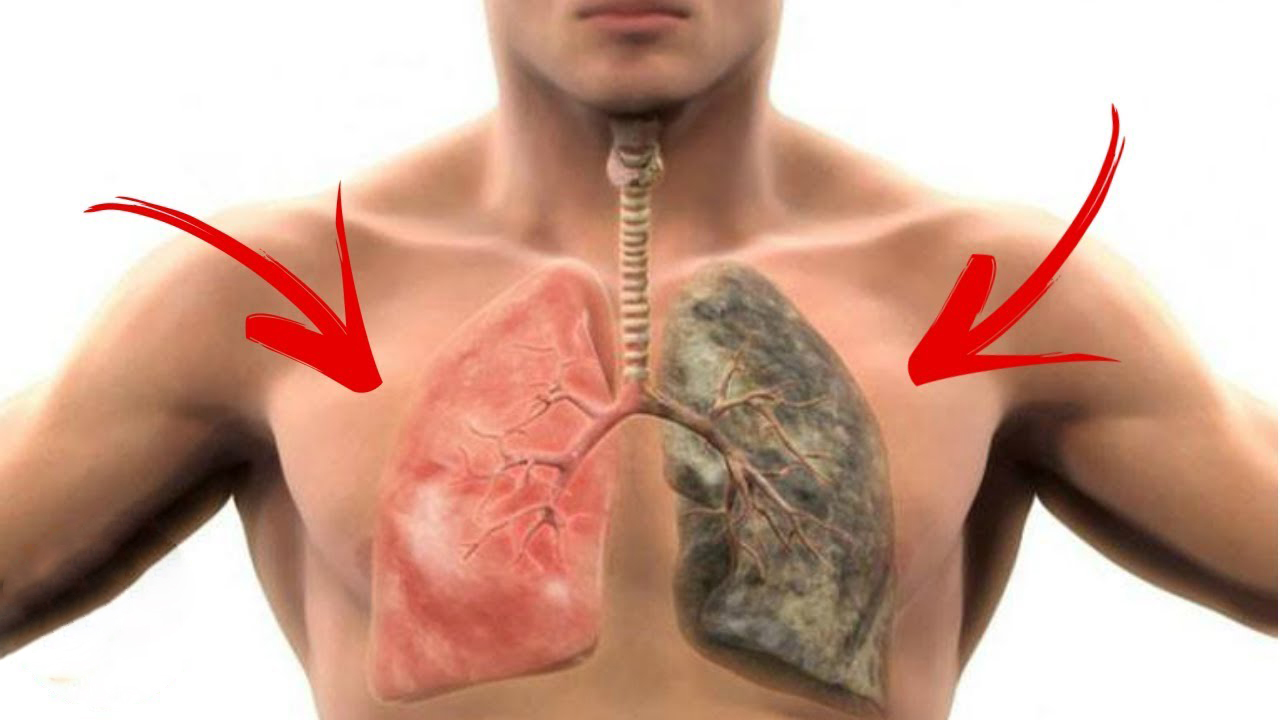 طريقة علمية لتنظيف الرئتين من اثار التدخين حتى لو استمريت بالتدخين